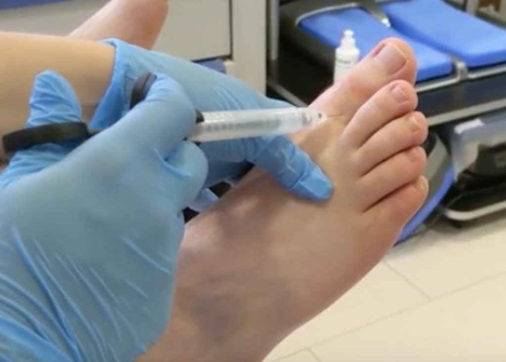 Hi followers!! 

Please can you help us out. We've been trying to make our youtube channel better for you. Check out our latest vid, please like, share and subscribe!! 
youtu.be/aLmBoHKHGSU