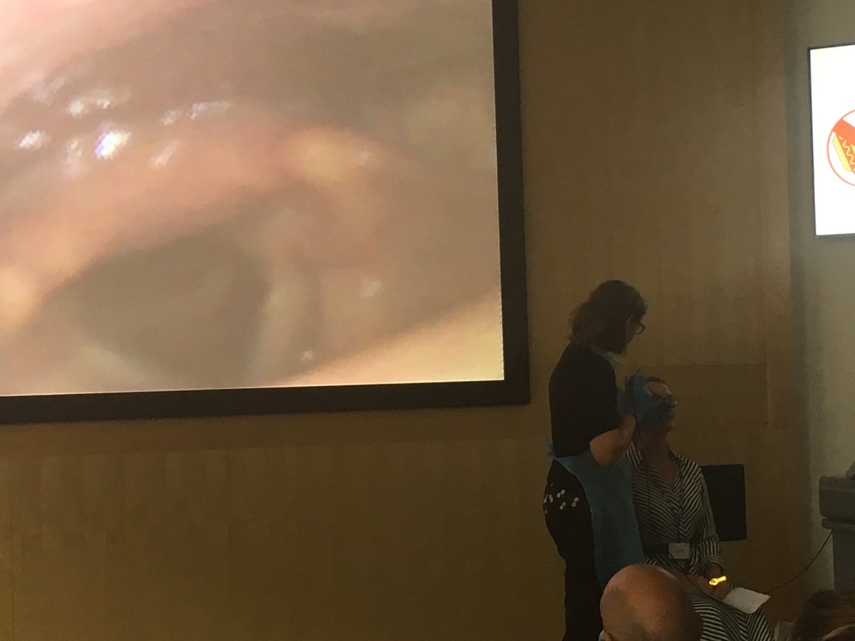 SLTLoulou's tweet photo. I am always so inspired when I see airway scoping. I know. I’m weird. Thank you @claire_slinger for sharing your skills & knowledge, @leehughes40 for showing your larynx & @rachaelmoses for explaining everything incl MI:E #inspiring #airway #advancedtracheday https://t.co/3TzJIEsjU5