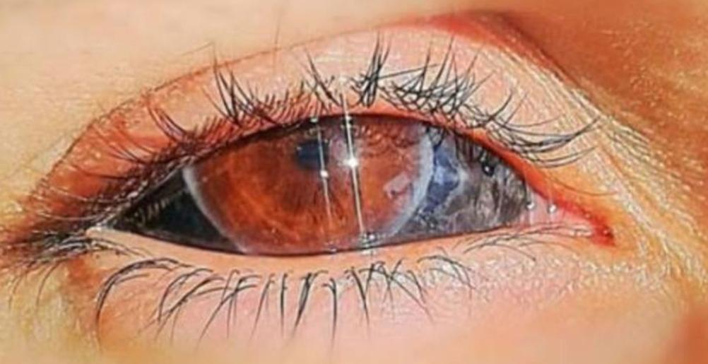 le_Parisien's tweet photo. Une femme de 24 ans condamnée à un an avec sursis pour pratique illégale de la médecine et blessures involontaires : elle tatouait le blanc des yeux dans son salon https://t.co/1JjCZJ6Bau https://t.co/9CHW3nZl0A