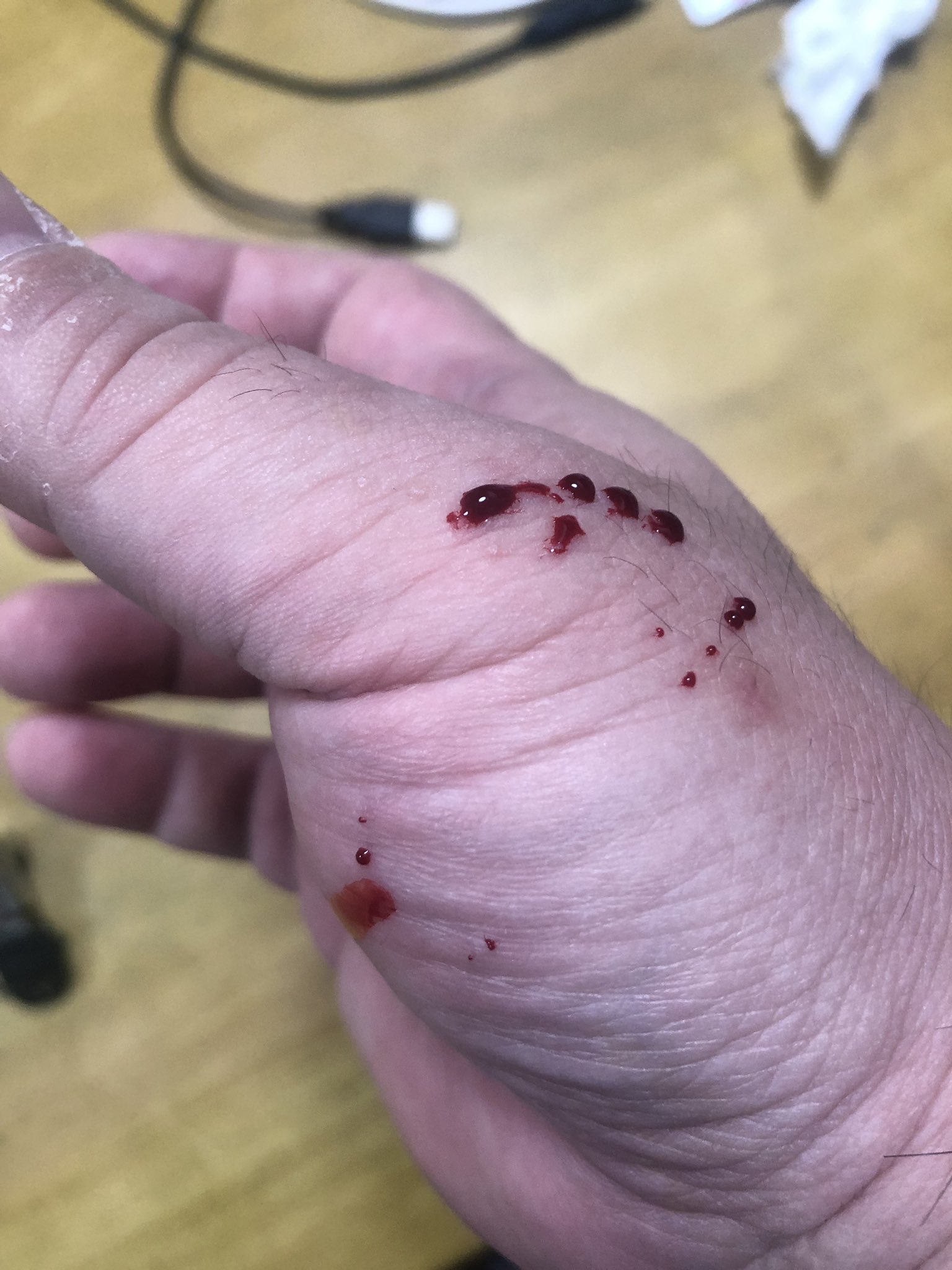 とっしー 霜降り 痛 たまちゃんに噛まれた 初噛まれ 笑笑 びっくりした やっぱりお腹空いてる時のハンドリングは無理があったか ボールパイソン たまちゃん 噛まれる ハンドリング T Co Pfbw0vahtb Twitter
