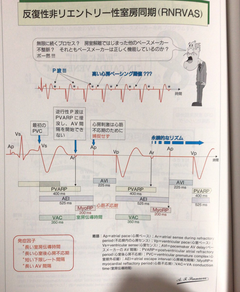ひろ 循環器内科 Rnrvasってよく聞くけど今日初めて経験した 心内心電図ではar Apと心房作動が連続するのが発見の鍵ですね イラストで学ぶ心臓ペースメーカー 医学書院 より