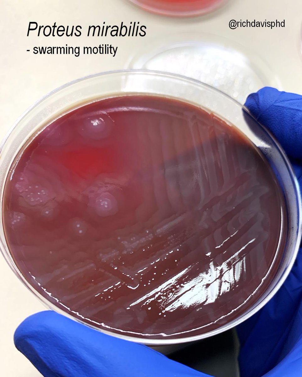 proteus mirabilis swarming motility