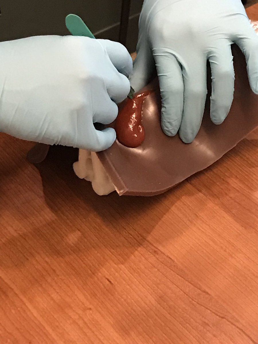 t_reed_t's tweet image. 3D printing and ketchup. Great combo for cric training @LoyolaEM! #SimEd @LoyolaHealth @LoyolaHSD