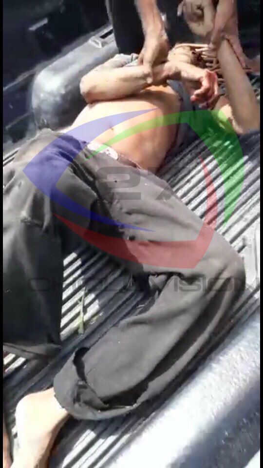 Choluvision27's tweet photo. Adulto mayor sufre accidente en Santa Cruz Marcovia y es trasladado al hospital escuela universitario.

#Choluteca #Honduras https://t.co/Y95l4BxcgX