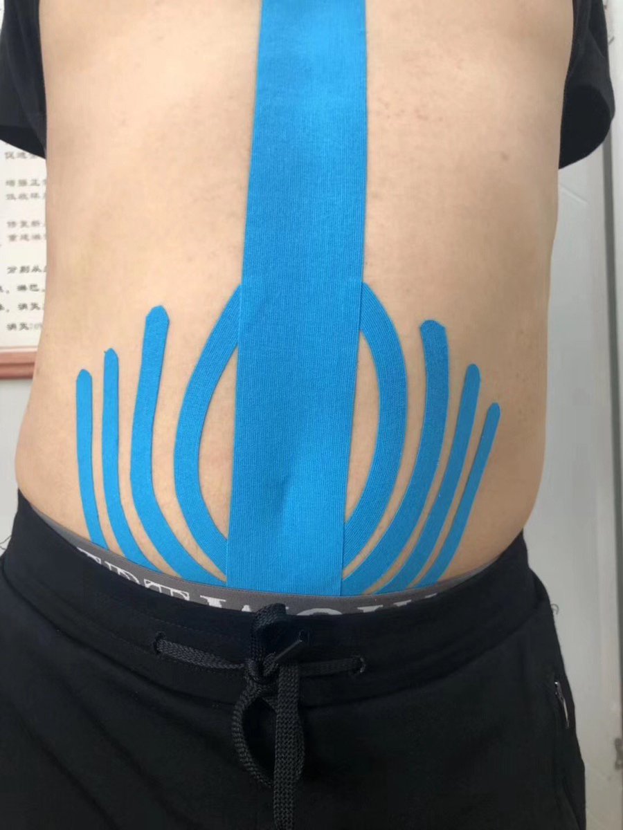 DLbandage's tweet photo. We will say the most complicated and variable symptoms appear in the waist, hope we can help you recovery from the pain.#kintape #dlbandage #kinesiologytape#TraditionalChineseBiomimeticsMedicine#TCBM https://t.co/zF91dAZWZD