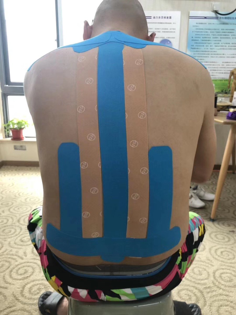 DLbandage's tweet photo. We will say the most complicated and variable symptoms appear in the waist, hope we can help you recovery from the pain.#kintape #dlbandage #kinesiologytape#TraditionalChineseBiomimeticsMedicine#TCBM https://t.co/zF91dAZWZD
