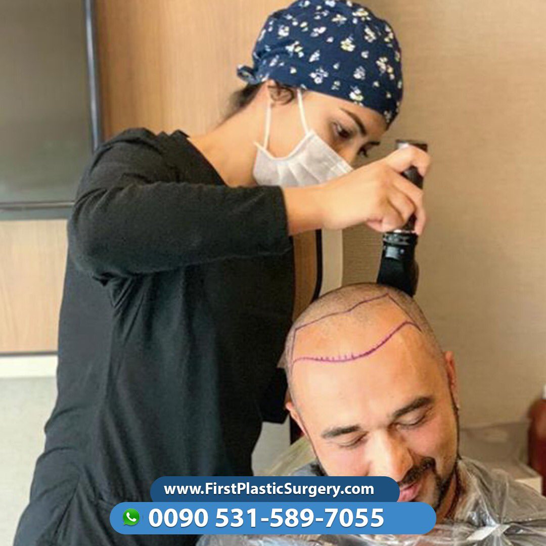 CosmeticsTurkey's tweet image. 💇🏻‍♂️Recover your hair again 💇🏻‍♂️ Contact us via Viber/WhatsApp 🇸🇦🇹🇷🇫🇷🇬🇧🇩🇪🇳🇱
📞00905315897055 ☎
firstplasticsurgery.com
😍😍🇹🇷🇹🇷😍🇹🇷😍🇹🇷😍🇹🇷🇹🇷😍😍🇹🇷😍😍
#facelift #cosmeticsurgery #confidence #selfconfidence #antiaging #naturalresults #eastcoastplasticsurgeon