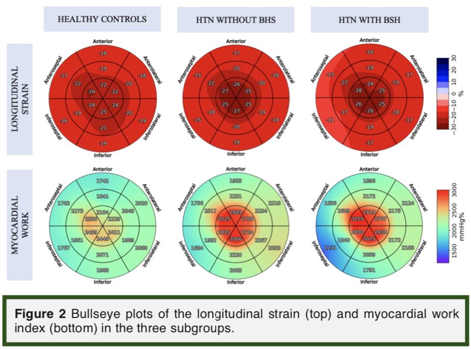 FiLoncaric's tweet photo. Amongst 4500 abstracts at the #ESCCongress, I'm proud to say my #PhD abstract on #myocardialwork in #hypertension was awarded as one of 9 best moderated posters in #Paris. It's all thanks to an amazing team! @masitges @PICnetEU @MacieyMarciniak @JoaoFilipeFern4 @lsanchisruiz https://t.co/383Znpo0lw