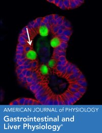physiogenex's tweet photo. We are proud to announce the publication of our collaborative work with the team of Dr. Laurent Martinez (INSERM) on our 3-week NASH mouse model in the @APSPhysiology : https://t.co/GyxOw3WmIT
#NASH #dietarymodel #drugdevelopment https://t.co/olP9ZJcbZh