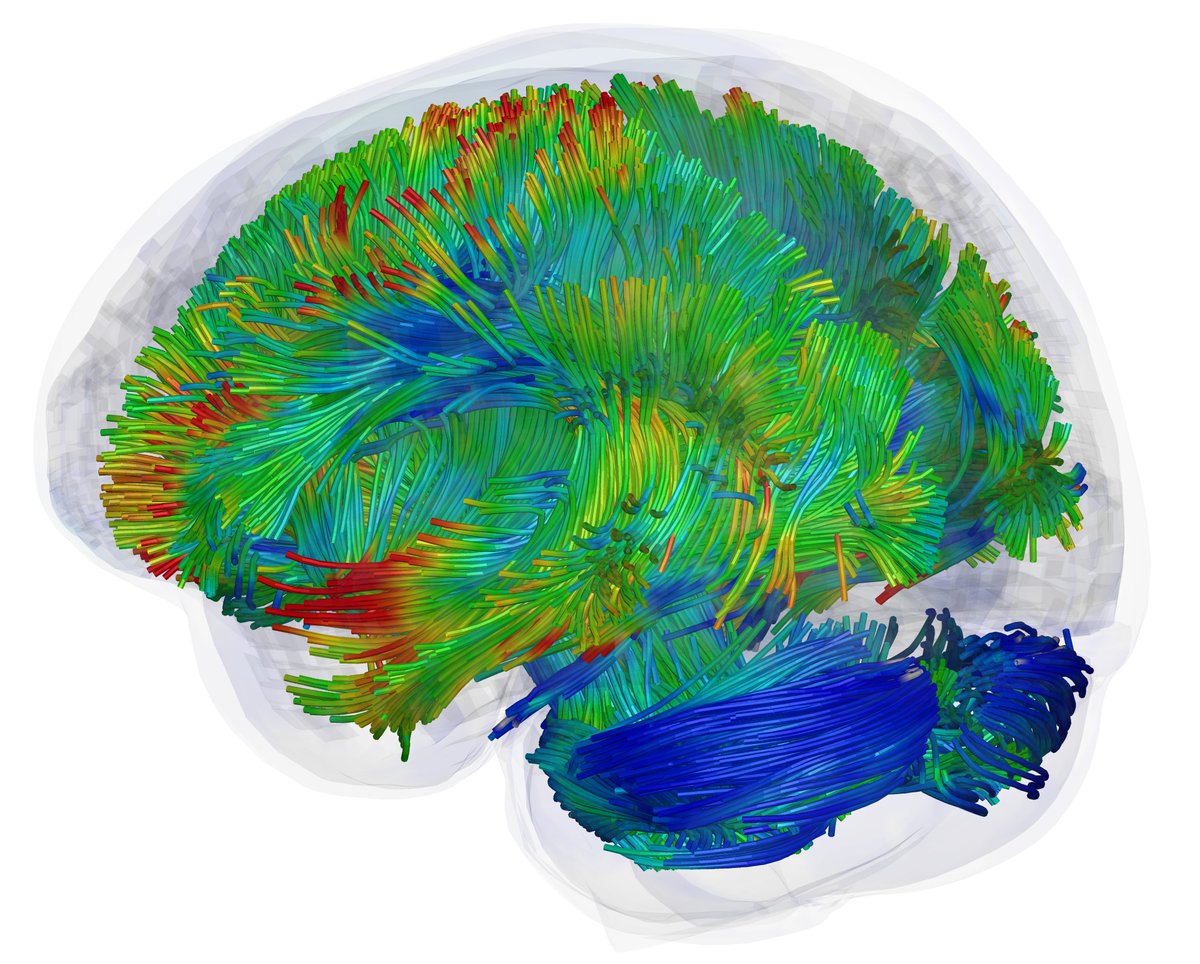 ABME (@abmejournal) on Twitter photo Congratulations to Taotao Wu for having your article on modeling axonal fiber tracts in the brain featured on our cover this month! Part of our special issue on brain trauma modeling <a href="/UVAEngineers/">UVA Engineering</a> @AANMember <a href="/HumanConnectome/">HCP News</a>
link.springer.com/article/10.100… Congratulations to Taotao Wu for having your article on modeling axonal fiber tracts in the brain featured on our cover this month! Part of our special issue on brain trauma modeling <a href="/UVAEngineers/">UVA Engineering</a> @AANMember <a href="/HumanConnectome/">HCP News</a>
link.springer.com/article/10.100…