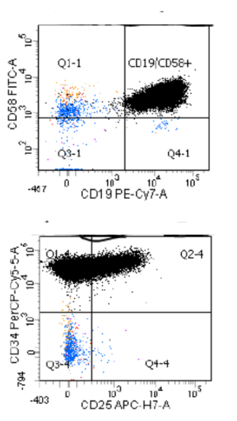 Chandra Krishnan, MD (@hematogones) on Twitter photo <a href="/sanamloghavi/">Sanam Loghavi, MD صنم لغوی 🔬🧬</a> We routinely assess for CD25 expression on BALL, to help address the possiblity of Ph+ or Ph-like phenotype. Most CD25 expressing cases we have seen correspond to IgH-CRLF2 rearrangement.
Note, the CD25 expression here can be heterogeneous or very dim! #hemepath #flowcytometry <a href="/sanamloghavi/">Sanam Loghavi, MD صنم لغوی 🔬🧬</a> We routinely assess for CD25 expression on BALL, to help address the possiblity of Ph+ or Ph-like phenotype. Most CD25 expressing cases we have seen correspond to IgH-CRLF2 rearrangement.
Note, the CD25 expression here can be heterogeneous or very dim! #hemepath #flowcytometry