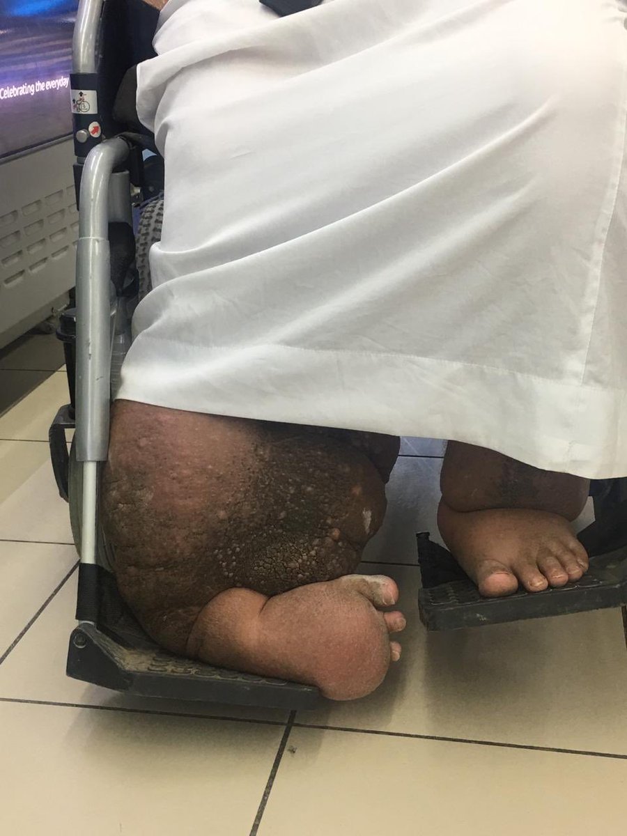 Abdulmane's tweet photo. قبل قليل وصلت لي هذه الحالة
دعواتكم له
الله يشفيه ويعافيه 
الصحة لايعرف قدرها إلا من فقدها
عسى ربي لايريكم مكروه في عزيز ولاحبيب https://t.co/088NLRBB46
