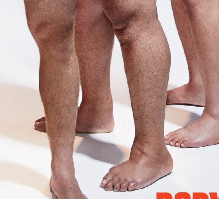 fauxklieman1's tweet image. I have a lot of questions about this knee/ankle/foot.