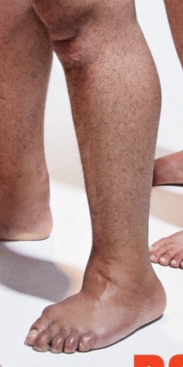 fauxklieman1's tweet image. I have a lot of questions about this knee/ankle/foot.