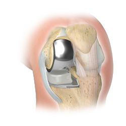 ReadingHip&KneeUnit tweet media