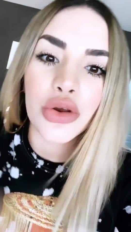 Vivimtz's tweet photo. @ZYTJavier Claro que no son labios naturales, es inevitable no ver el cambio. https://t.co/r5Gp9M3R79