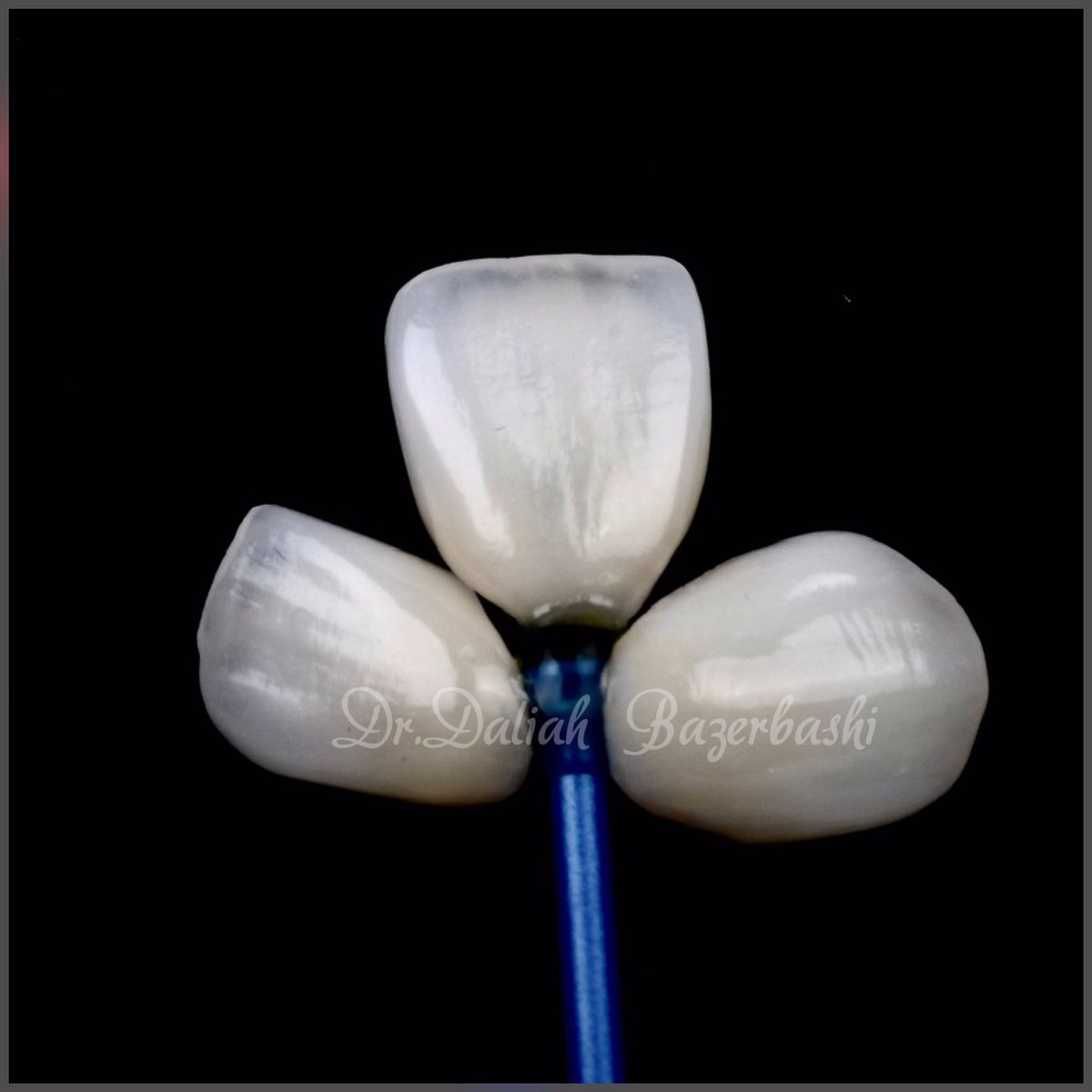 daliah_dr's tweet photo. Nothing  matches the beauty of natural look.
#dentist #dentistry #dentistas #dentistrylife #dentistrymyworld #cosmeticdentistry  #dentalveneers #dentalphotography #dentalclinic #dentalcare #dentalhumor #veneers #veneersdubai  #smiletransformation #teethwhitening  #whiteteeth https://t.co/Daa2U6hxKm