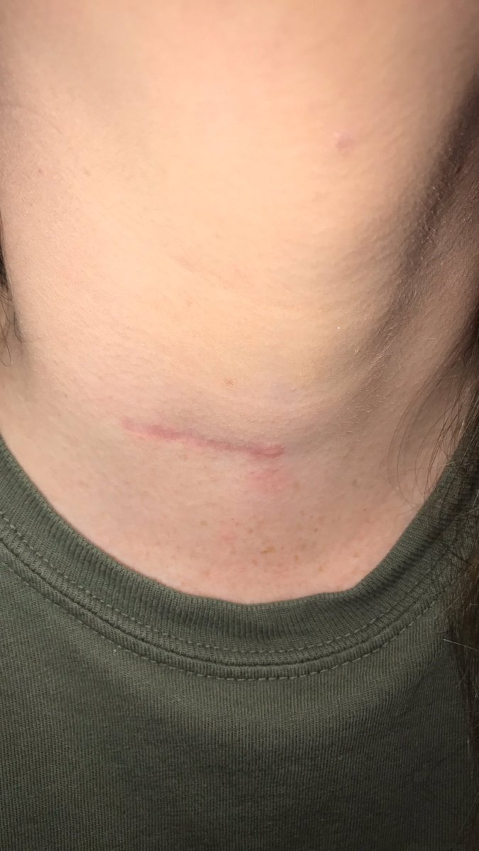 hannshaver's tweet photo. GOD IS SO GOOD—It has only been SIX months since I broke my neck, tore all of my upper back muscles, and tore the ligaments in my neck, BUT I am so excited to say that I will be back on the sidelines cheering for @MOSOFOOTBALL TONIGHT !!! @MOSOLionCheer @mososportsad @mososports https://t.co/yONqXbHUM7