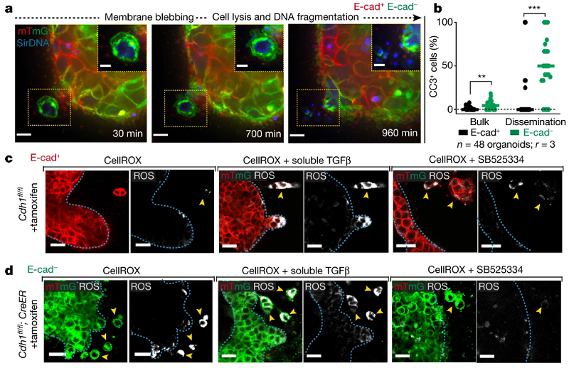 organoidscience's tweet photo. Primary mammary tumor #organoids were used in this @Nature paper to show that E-cadherin promotes metastasis in diverse models of invasive ductal carcinomas. @HopkinsMedNews https://t.co/PekSeHNKOV https://t.co/B3WQOdCrk4