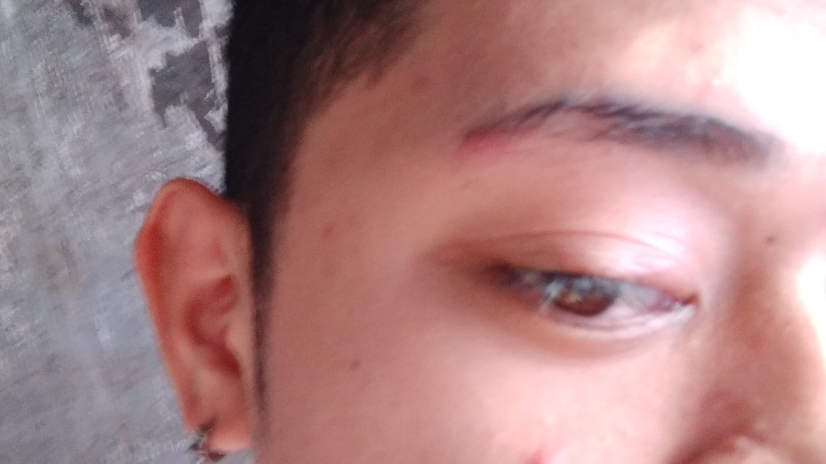 AljunStyles's tweet image. So discusting