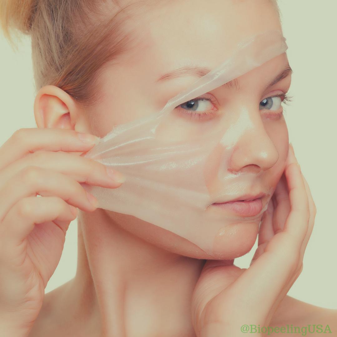 BioPeelingUSA's tweet photo. A chemical peel is a technique used to improve the appearance of the skin on the face, neck or hands. A chemical solution is applied to the skin that causes it to exfoliate and eventually peel off. The new, regenerated skin is usually smoother and less wrinkled than the old #skin https://t.co/bBDkyMpWgV