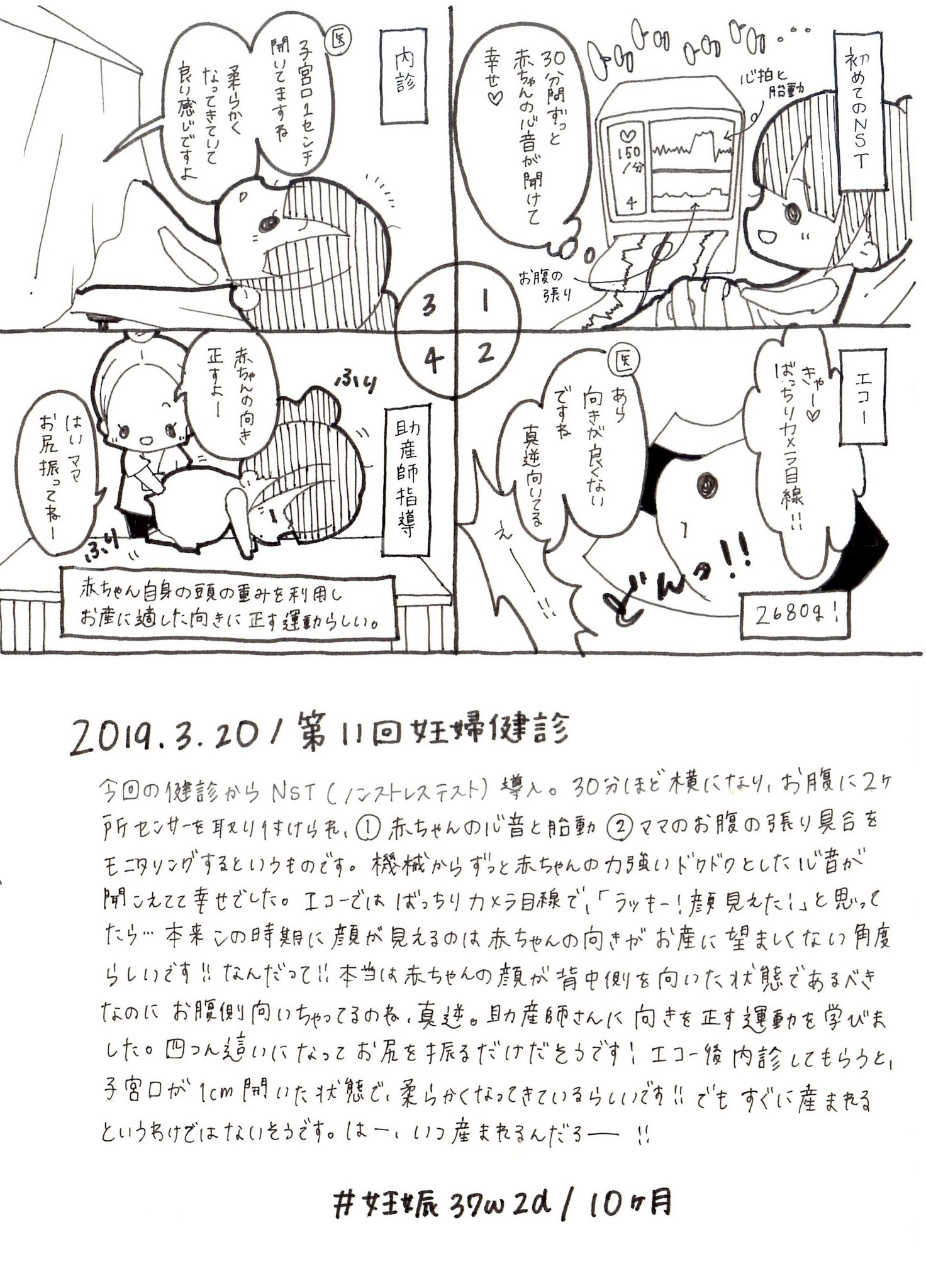 みん 3y0m 1m 育児漫画 19 3 もう37週に入ったのでいつ生まれてきてもいいよー 正期産に入っての妊婦健診 逆子ではないけど赤ちゃんの表裏が真逆だそうで それ以外は順調です エコー お腹の写真載せます 閲覧注意 育児漫画 育児日記