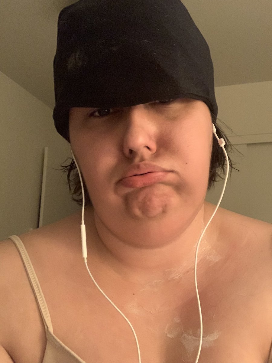 pdxfashionista's tweet photo. Behind the scenes, a thread: 1. Remicade Infusion day. 2. Crazy gazillion IV pokes bruises. 3. Tired and fed up. 4. My nighttime regimen. Contโ in comments. #SickPics #chronicillness #Migraine #Fibromyalgia #Psoriasis #psoriaticarthritis #NervePain https://t.co/OiBCRh99ir
