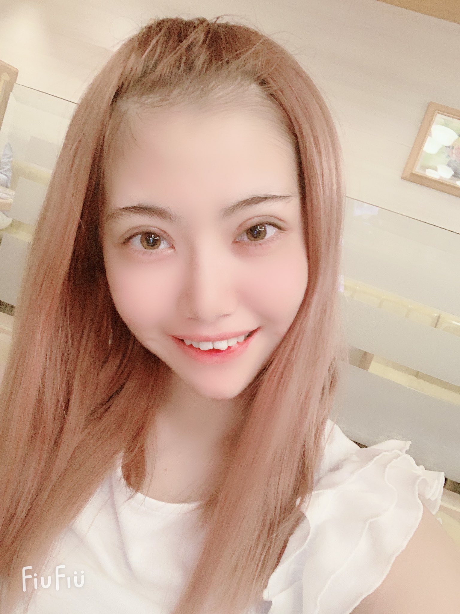 ぴめ 整形してよかった 院長先生に押切もえに似てるって言われた 経過が楽しみすぎる T Co S0vy7e1cxi Twitter