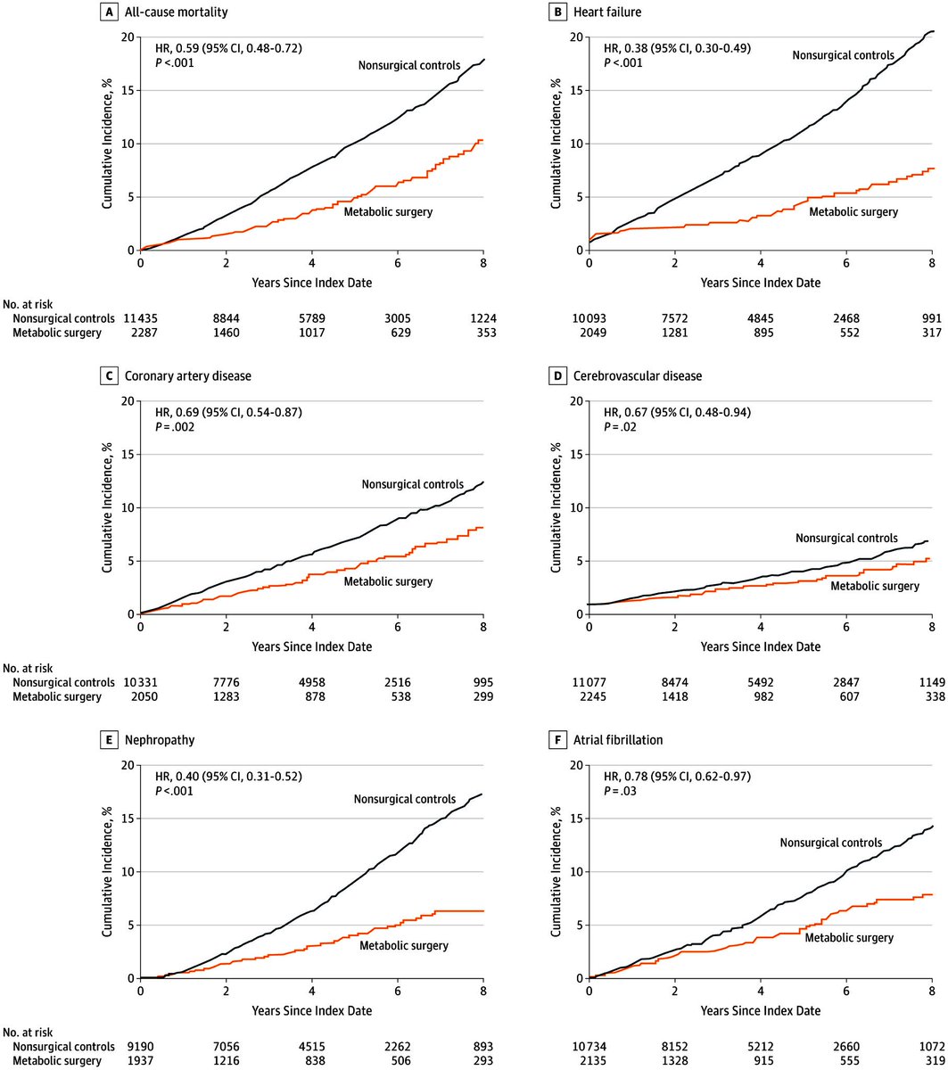 #BariatricSurgery is associated with striking 40% ⬇️ in adverse cardiovascular outcomes. Specifically,

41% ⬇️in death
62% ⬇️in heart failure
31% ⬇️in heart disease
33% ⬇️in stroke
60% ⬇️in kidney failure 

By operating on 13 patients, 1 life can be saved

jamanetwork.com/journals/jama/…