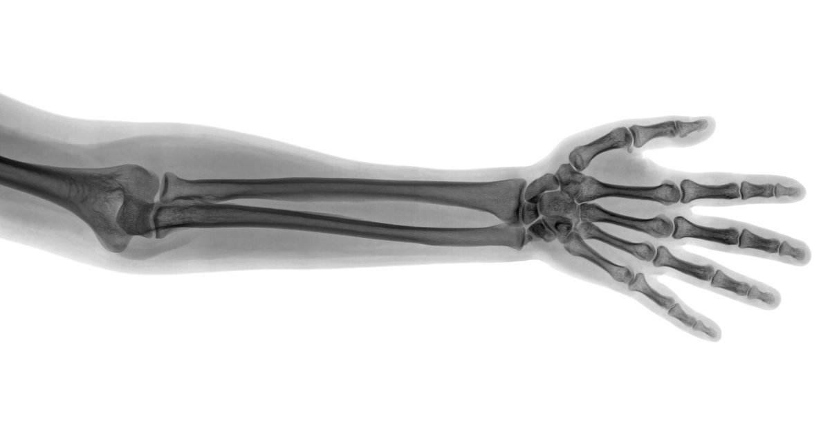 StortPhysio's tweet photo. Come and join us for the 2nd Jointworks Seminar on Saturday the 21st of September at Holy Trinity Church Bishops Stortford! Gain a valuable insite into managing your joints! #joints #physio #healthcare #free #bishopsstortford #stansted #sawbridgeworth https://t.co/cKNSvfUQwi