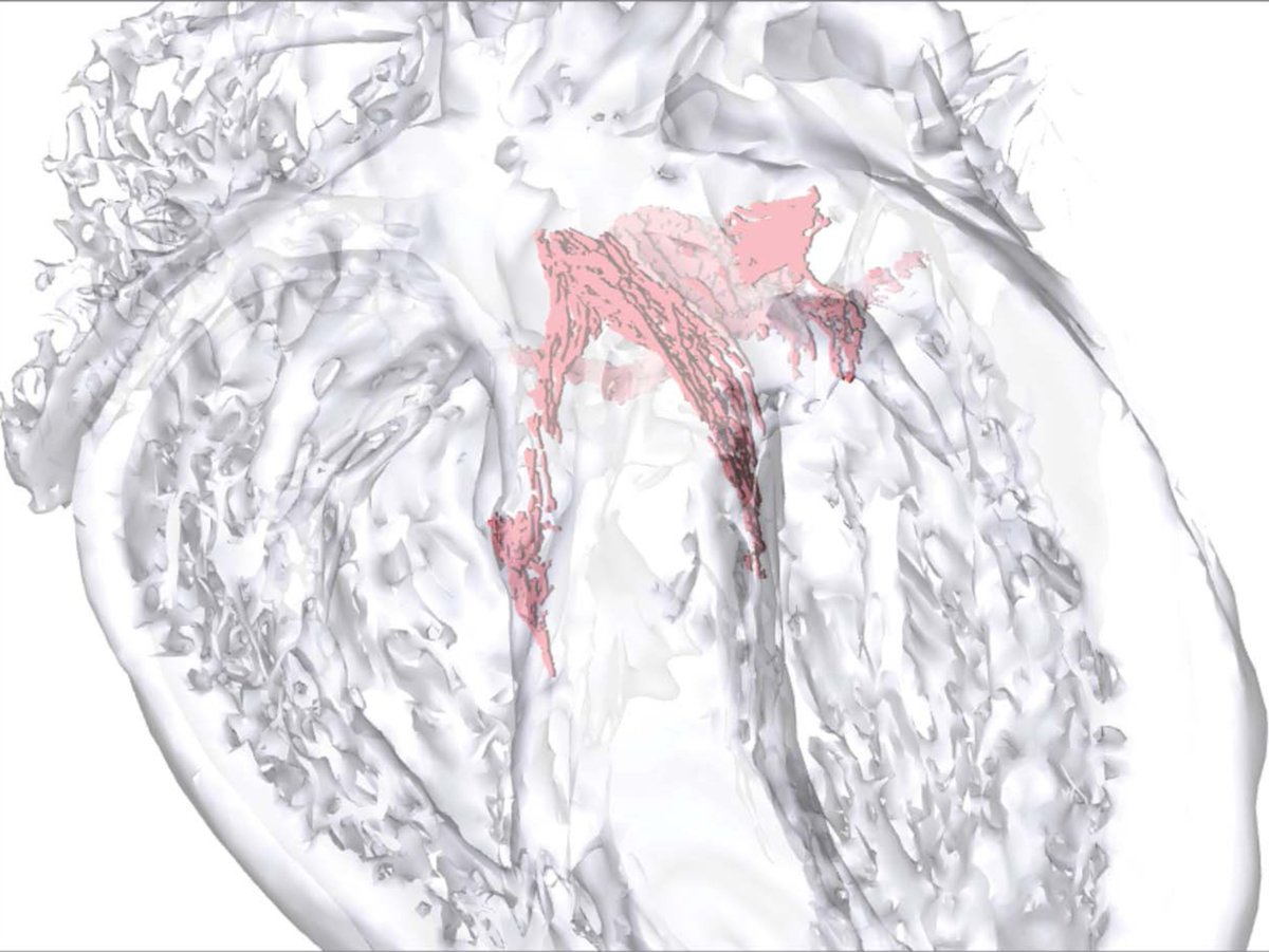 CircRes's tweet photo. #SNP within HAND1, a novel LV enhancer, disrupts the #CardiacConductionSystem morphogenesis via inefficient GATA4-DNA binding. https://t.co/D6Dx6NeCit https://t.co/xBjRCXBsSm