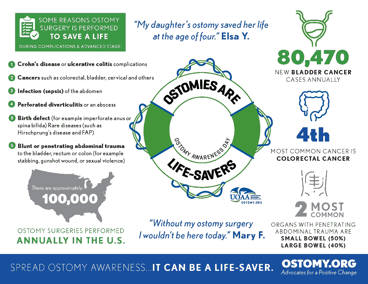 Today is Ostomy Awareness Day. See how #ostomy surgeries save lives and help @uoaa spread the word that #OstomiesAreLifesavers. #ColorectalCancer #IBD #CrohnsDisease #OstomyDay2019 
bit.ly/2ZJTdkY