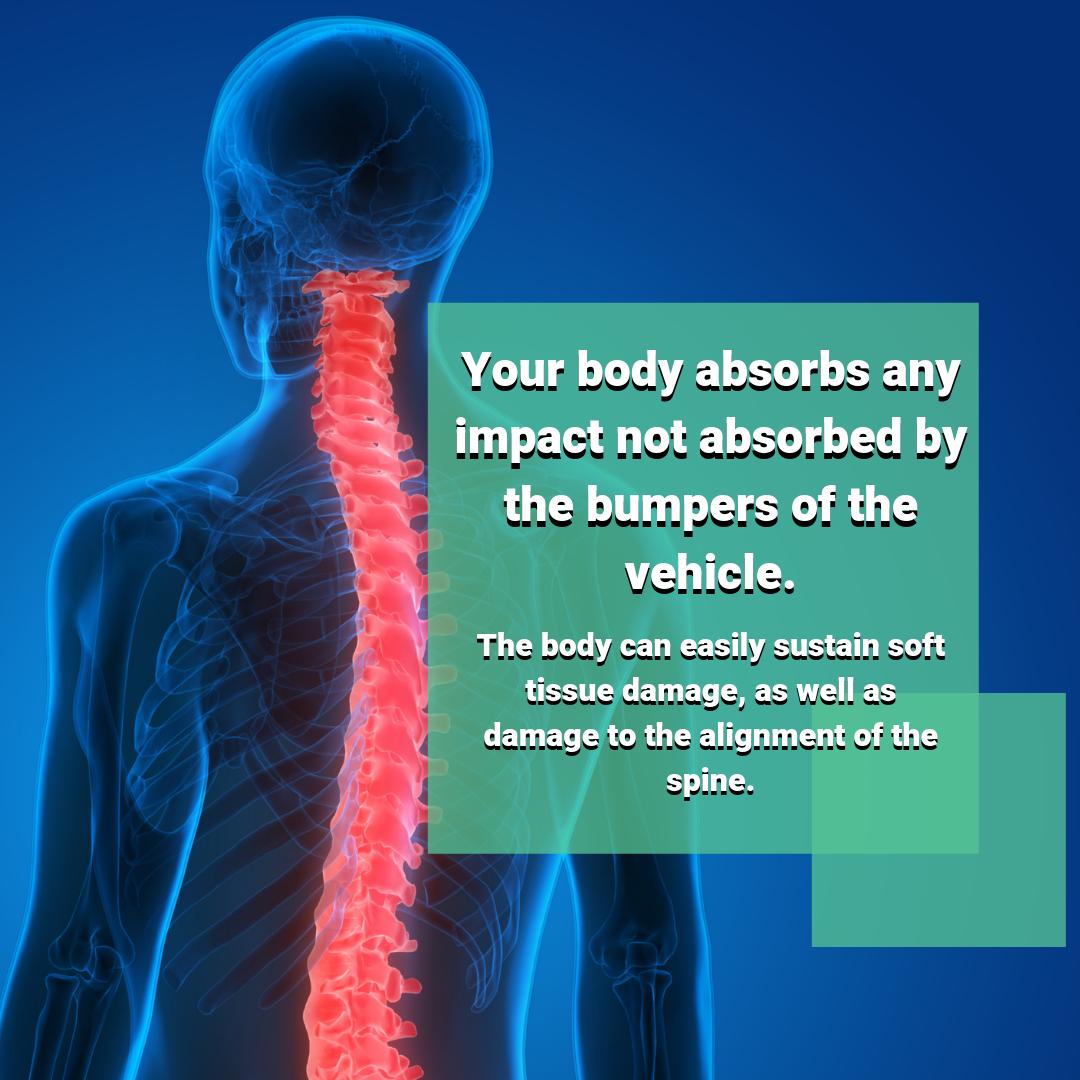 The body can easily sustain soft tissue damage, as well as damage to the alignment of the spine. #orlando #orlandoflorida #orlandochiropractor