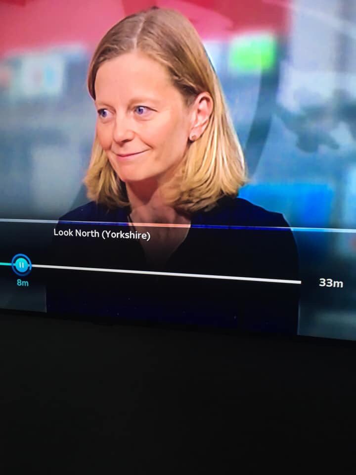 Amazing feature on  <a href="/BBCLookNorth/">BBC Yorkshire</a> on Organ donation. Thank you again to the amazing Bill &amp; Donna. You are our heroes. <a href="/OPinderfields/">OrganDonationPinderfields</a> <a href="/NHSOrganDonor/">NHS Organ Donation💗🫀🫁</a> #PassItOn #OrganDonationWeek