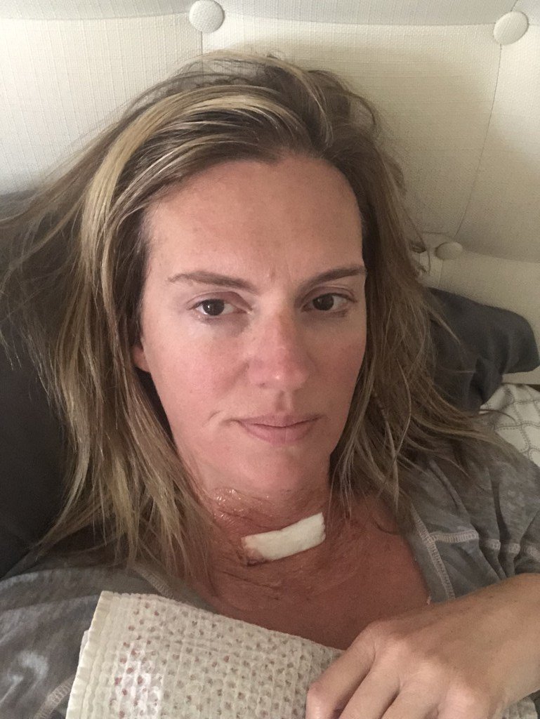 4ever_Charmd's tweet photo. Thyroid Cancer and the Road to Recovery Days 1-3 https://t.co/9vqUhMAbMF https://t.co/AsGvipfT2V