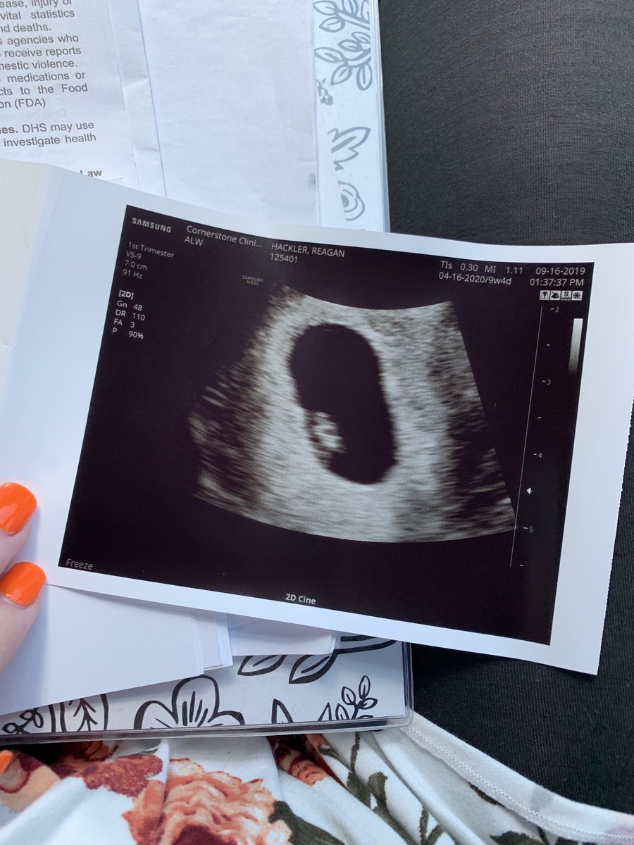 raeganhackler's tweet photo. God has blessed me SO big &amp; I could not be more thankful for our little Jelly Bean. The only thing I’ve ever wanted in life was to be a mother &amp; it’s finally here. 🥰   P.S. we are praying for a boy! May 05, 2020 please hurry. 💙 https://t.co/VmdzRAgHHe