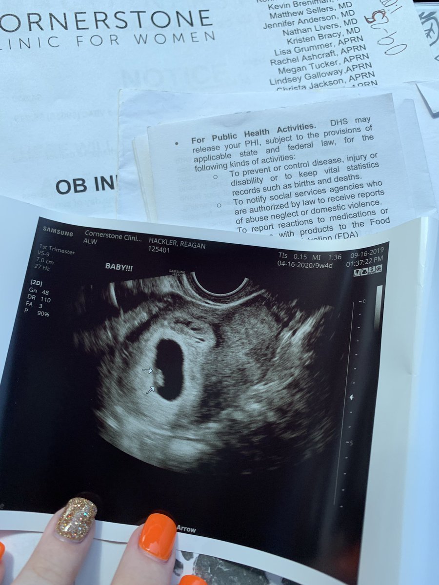 raeganhackler's tweet photo. God has blessed me SO big &amp; I could not be more thankful for our little Jelly Bean. The only thing I’ve ever wanted in life was to be a mother &amp; it’s finally here. 🥰   P.S. we are praying for a boy! May 05, 2020 please hurry. 💙 https://t.co/VmdzRAgHHe