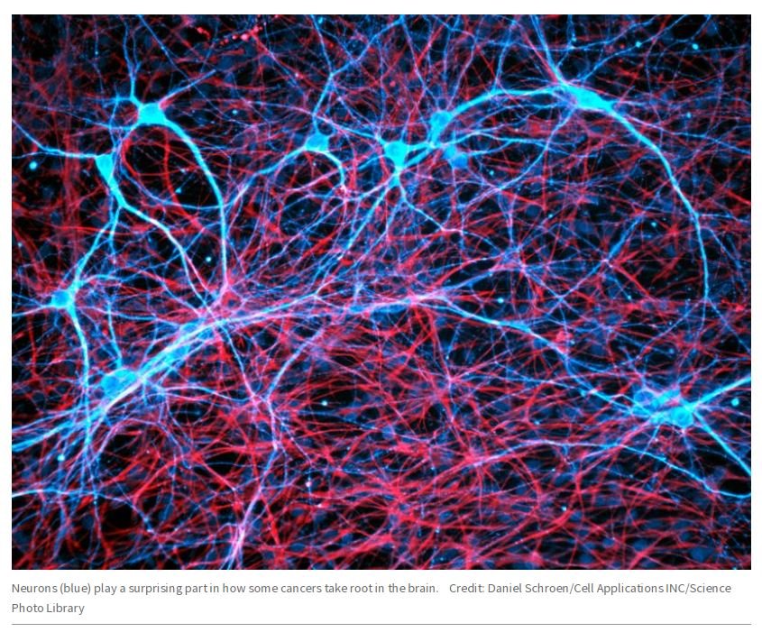 NatureCancer's tweet photo. ๐ฌ Three reports today @nature show that tumor cells can engage in synaptic connections with neurons, and this reciprocal interaction impacts the way brain tumors progress #NatureCancerPicks #thread ๐๐๐ https://t.co/6kLKeNcaY5