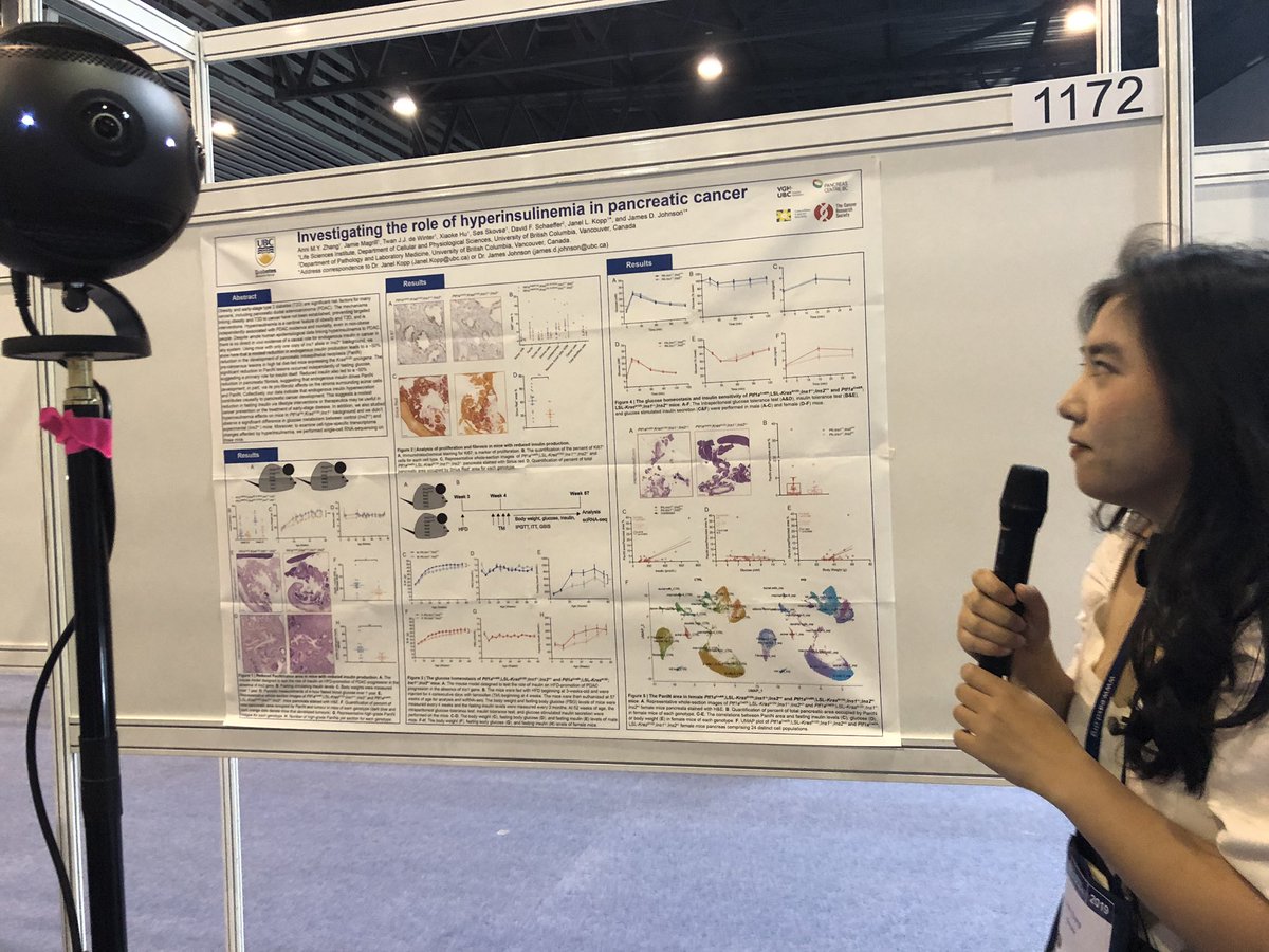 Jim Johnson, PhD (@jimjohnsonsci) on Twitter photo #EASD2019 <a href="/annizubc/">Anni Zhang, Ph.D.</a> presenting new work on her pancreatic cancer project. Hyperinsulinemia helps drive PanIN formation. Now we have some interesting single cell RNAseq data and a model with an even more modest reduction in circulating insulin. #EASD2019 <a href="/annizubc/">Anni Zhang, Ph.D.</a> presenting new work on her pancreatic cancer project. Hyperinsulinemia helps drive PanIN formation. Now we have some interesting single cell RNAseq data and a model with an even more modest reduction in circulating insulin.