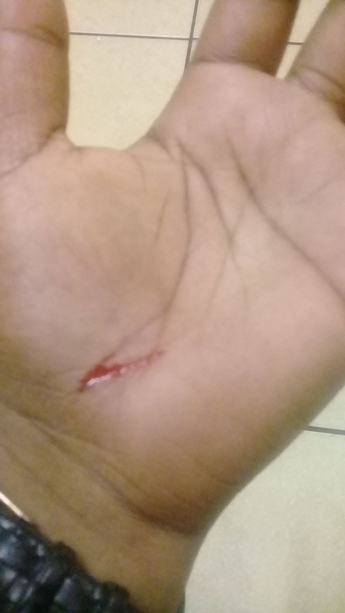 Kushley_kay's tweet photo. I literally almost got robbed few minutes ago walking to campus 😱😭😭😭💔 I'm still shaking but otherwise okay...
I thought I was fairly safe since it's broad daylight, the street is full of people and it's probably a 5 minutes walk from my place to campus
#ImNotNext
#shook https://t.co/6wPmi2lFDX