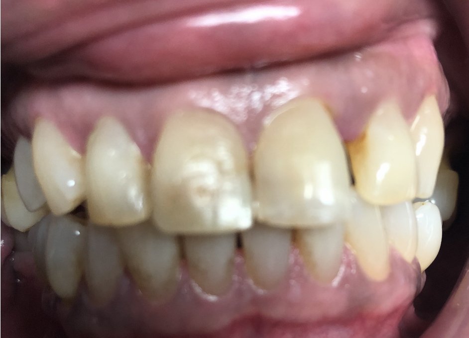Rick Kushner Dds On Twitter Couple Real World Bread Butter
