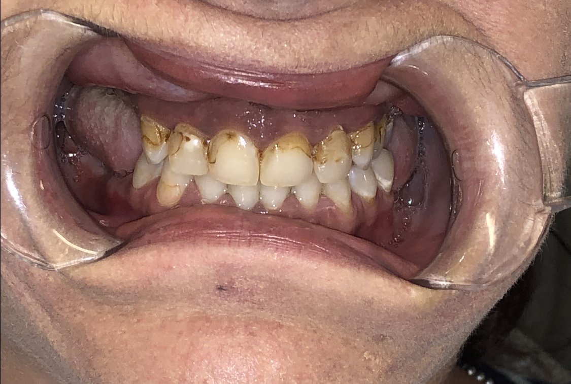 Rick Kushner Dds On Twitter Couple Real World Bread Butter