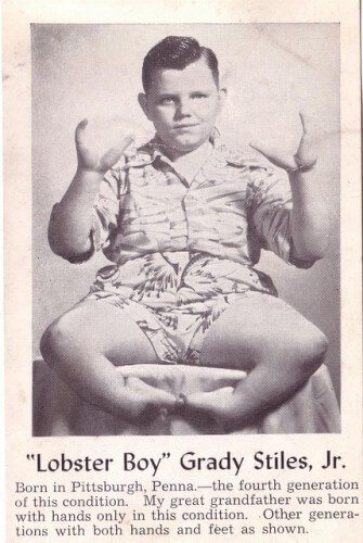 SpiritPod's tweet photo. Buckle up because we're taking you on a wild ride. First you'll learn about the murderous and wrathful Lobster Boy, and then... the worst thing you will ever hear. The curious case of a man named Tarrare, and the horrors his body contained.

https://t.co/JzTjpf2hfd https://t.co/kEXffEIjDb