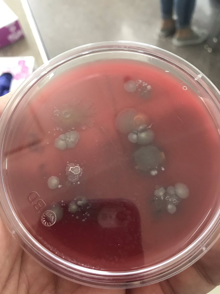 Just another example of the real world quality of CTE.  Health Occupations students testing their blood to determine blood type and inoculating microbiology plates to see what bacteria grows on their finger.
<a href="/sd129/">West Aurora School District 129</a> <a href="/WAAcademics129/">WAAcademics129</a>