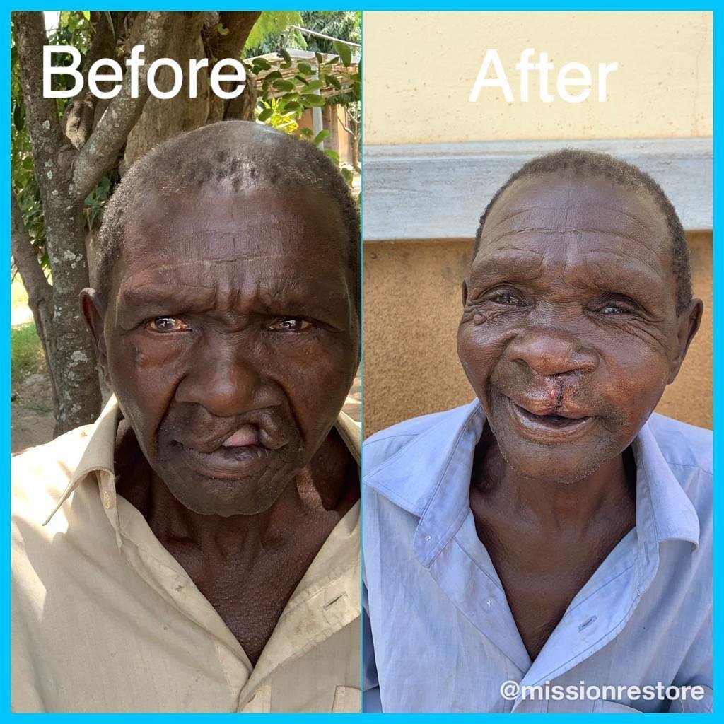 Mission: Restore tweet media