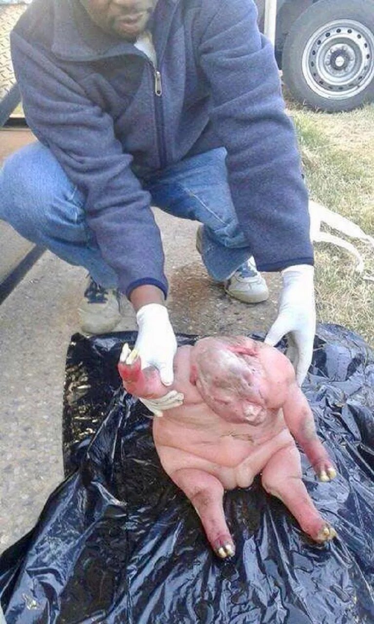 Dr. Chinonso Egemba on X: "These are even clearer pictures that surfaced  around 2017 with the same caption, There are possibilities that something,  either an infection or toxins interfered with the development