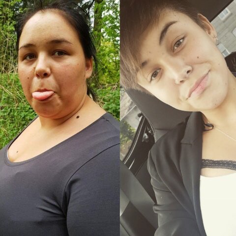 ngballoon's tweet photo. Gastric balloon helped Pernille, 23 year old danish lady, lose 53kg. Can you believe it? #weightloss #obesity #Denmark #sweden https://t.co/4eYrFBSLKC