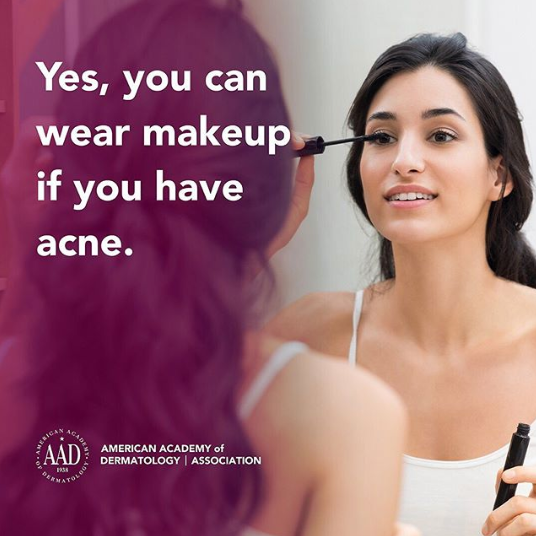 SFLSkin's tweet photo. If you have acne-prone skin, pick products that are oil-free or non-comedogenic. #aadskin
📸: Repost from @AADskin https://t.co/Zr5sRLrsgT