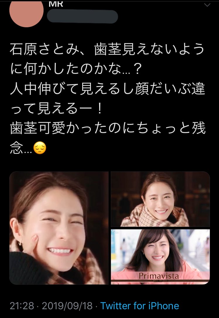 じゅんちゃん 話題のプリマヴィスタcm観たけど石原さとみ 様笑った時に歯茎見えるの気にしてたのかな 正面から見た時の人中の長さが目立つようになった 今まで石原さとみの歯茎気にならなかったし本当何よりもバランスが大事だね じゅんちゃん 話題のプリマヴィスタcm観たけど石原さとみ 様笑った時に歯茎見えるの気にしてたのかな 正面から見た時の人中の長さが目立つようになった 今まで石原さとみの歯茎気にならなかったし本当何よりもバランスが大事だね