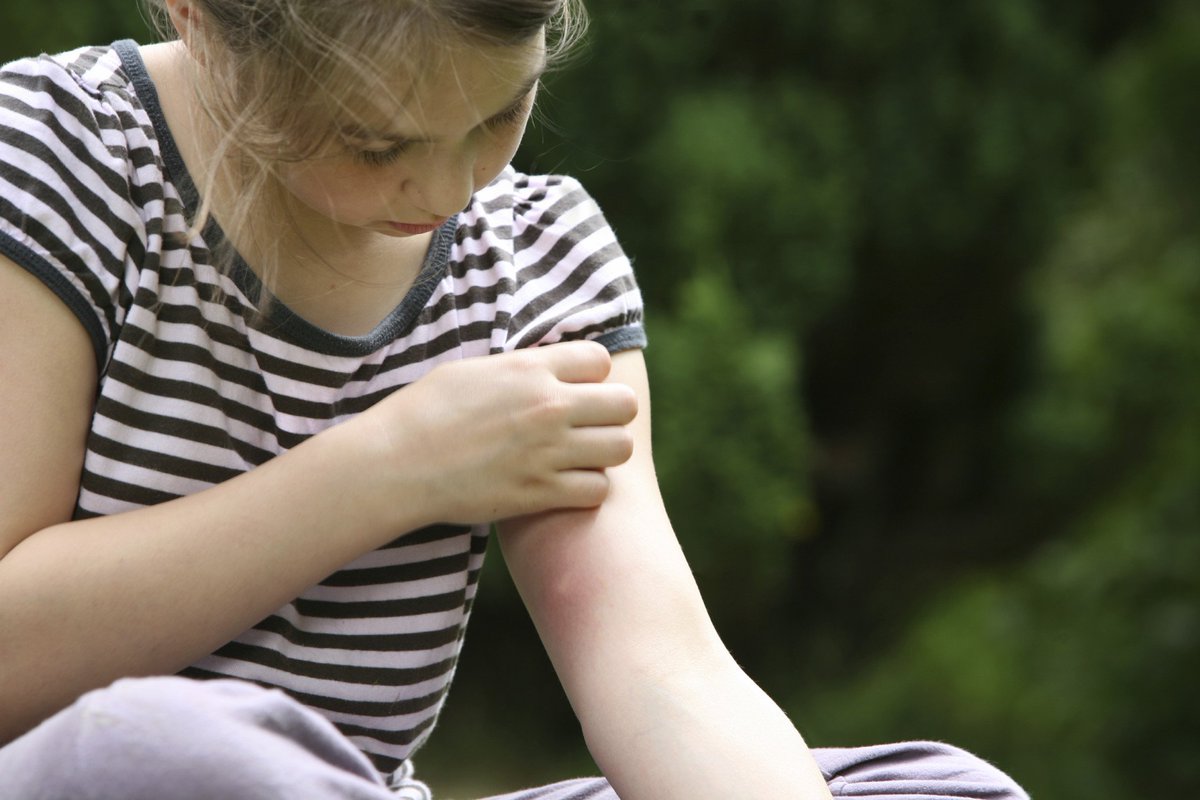 Most people are familiar with the sometimes maddening itching sensation of a mosquito bite. But why do mosquito bites itch, and why do they bite people in the first place?
pestworld.org/news-hub/pest-…